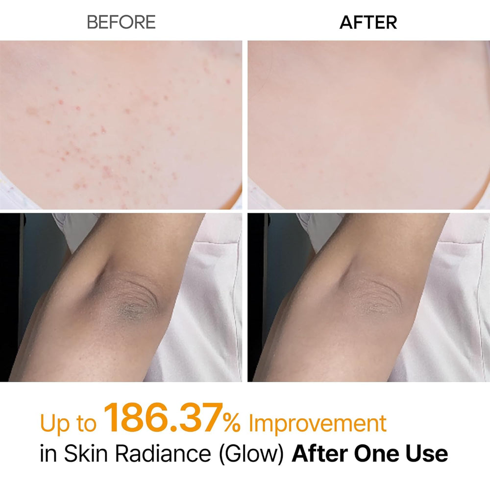 Dr.Melaxin - Kojic Acid Spray