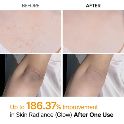 Dr.Melaxin - Kojic Acid Spray